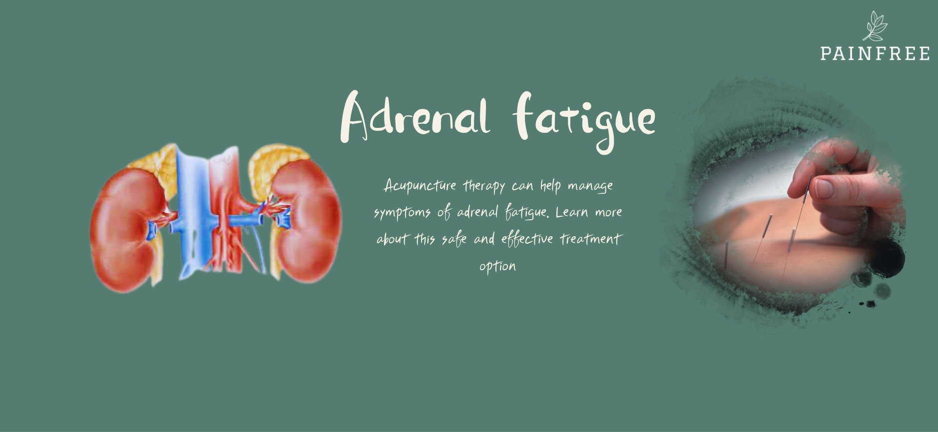 Acupuncture for Adrenal Fatigue